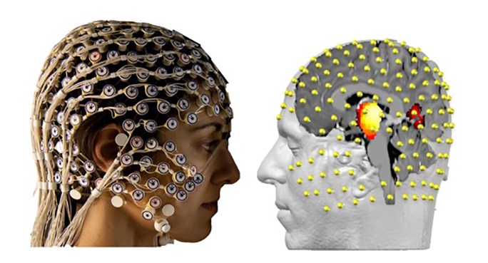 EEG Neuromarketing